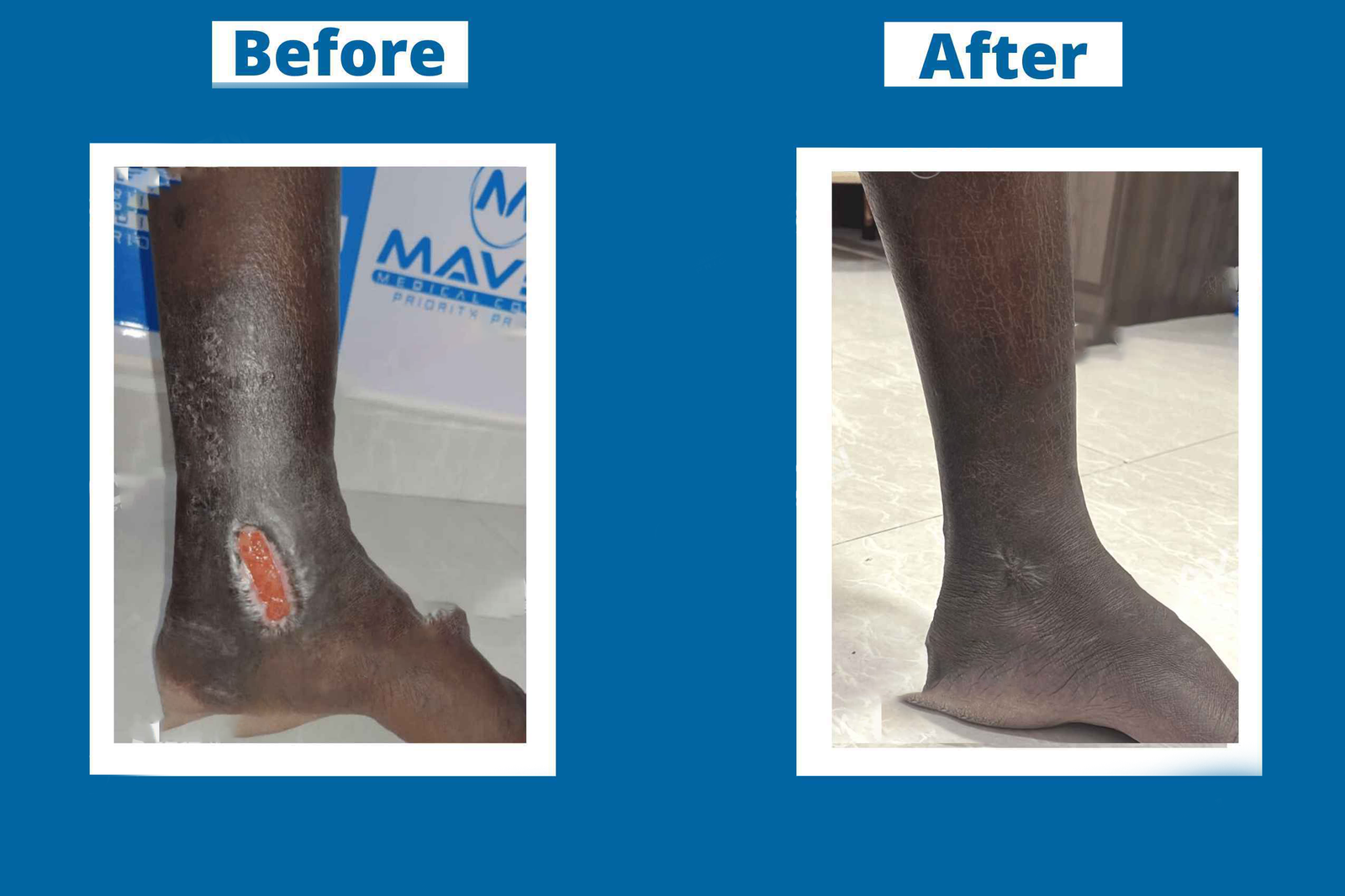 Recovery review